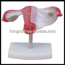 ISO Natürliche Größe Uterus Modell, Anatomische Uterus Modell